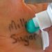 How to Get Permanent Marker Out of Your Skin