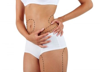 Liposuction in Turkey vs. UK: Comparing Cost, Quality, and Safety Standards