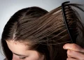 What Causes an Oily Scalp? And How to Actually Fix It